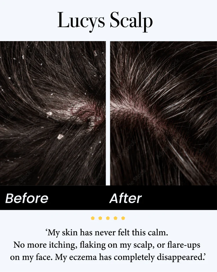 Seb Natural Calming Serum - Image 4